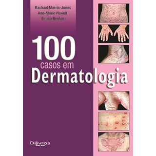 Livro - 100 Casos em  Dermatologia - Morris-jones/pwell