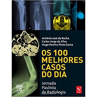 Livro - 100 Melhores Casos do Dia, Os - Rocha #
