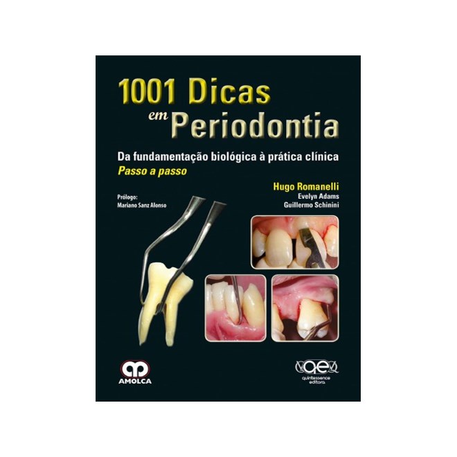 Livro - 1001 Dicas em Periodontia - da Fundamentacao Biologica a Pratica Clinica - Romanelli