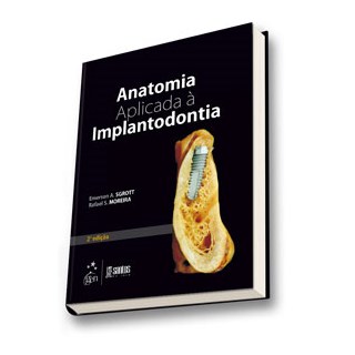 Livro - Anatomia Aplicada à Implantodontia - Sgrott