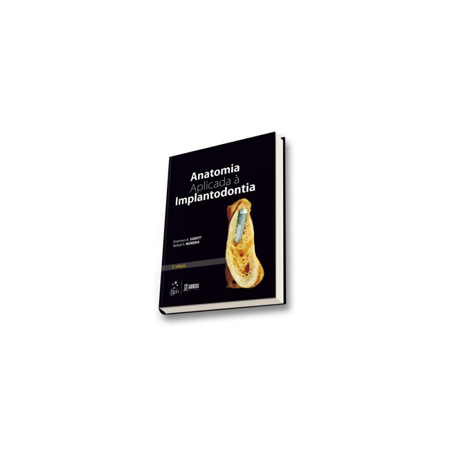 Livro - Anatomia Aplicada a Implantodontia - Sgrott / Moreira