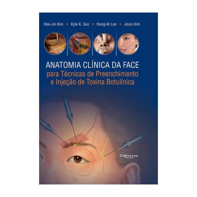 Livro - Anatomia Clinica da Face para Técnicas de Preenchimento e Injeção de Toxina Botulínica - Kim
