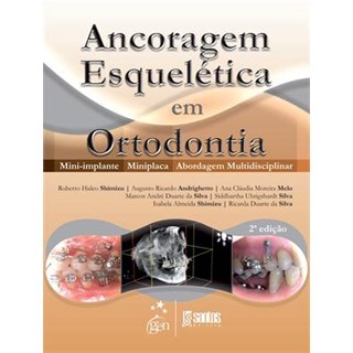 Livro - Ancoragem Esqueletica em Ortodontia - Mini-implante - Miniplaca - Abordagem - Shimizu/andrighetto