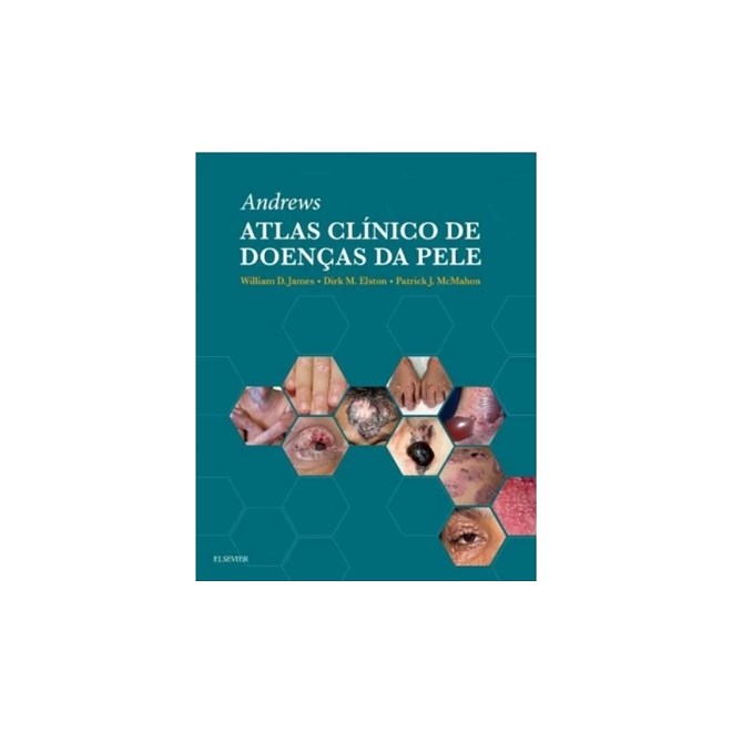 Livro - Andrews Atlas Clinico De Doencas Da Pele - James