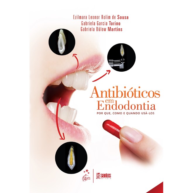 Livro Antibioticos em Endodontia : Porque, Como e Quando Usa-los - Sousa
