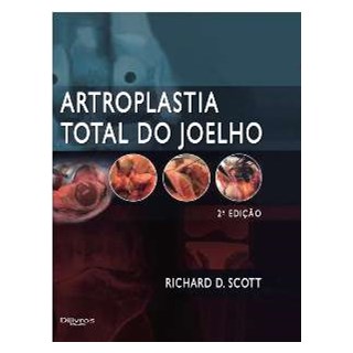 Livro - Artroplastia Total do Joelho - Scott