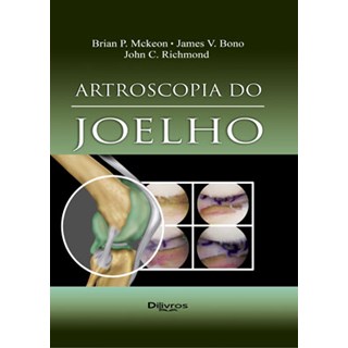 Livro - Artroscopia do Joelho - Mckeon