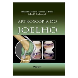 Livro Artroscopia do Joelho - Mckeon - Dilivros