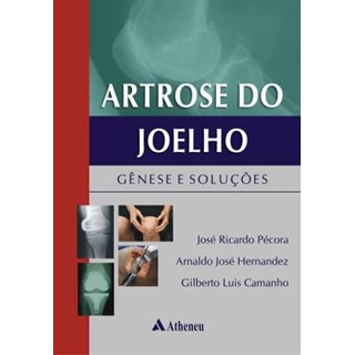 Livro - Artrose do Joelho - Hernandez