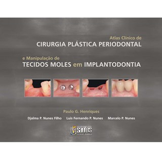 Livro - Atlas Clinico de Cirurgia Plastica Periodontal - Henriques/ Nunes Fil