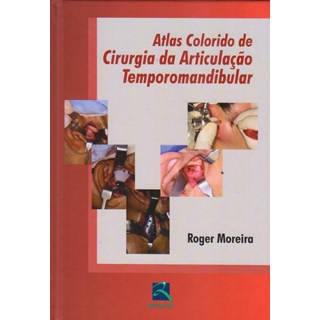 Livro - Atlas Colorido de Cirurgia da Articulação Temporomandibular - Moreira