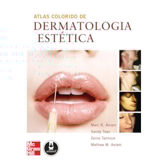 Livro - Atlas Colorido de Dermatologia Estética - Avram Livro - Atlas Colorido de Dermatologia Estética - Avram
