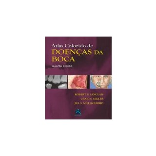 Livro - Atlas Colorido de Doenças da Boca - Langlais