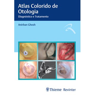 Livro - Atlas Colorido de Otologia: Diagnostico e Tratamento - Ghosh