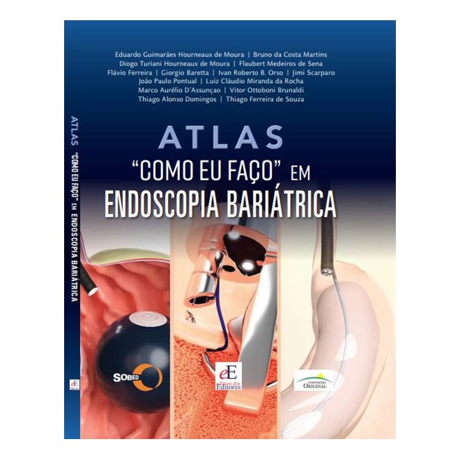 Livro Atlas  Como Eu Faço em Endoscopia Bariátrica - Moura - Editores