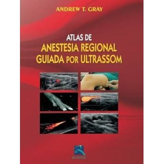 Livro - Atlas de Anestesia Regional Guiada por Ultrason - Gray