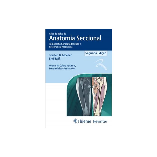 Livro - Atlas de Bolso de Anatomia Seccional - TC e RM - Vol. 3: Coluna Vertebral, Extremidades e Articulações - Moeller