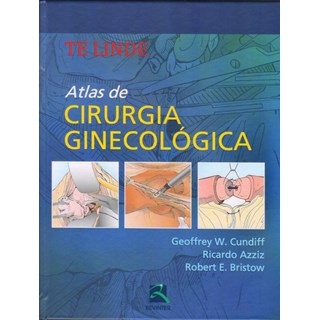 Livro - Atlas de Cirurgia Ginecologica - Te Linde/cundiff