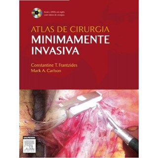 Livro - Atlas de Cirurgia Minimamente Invasiva - Acompanha Dvd - Frantzides/ Carlson