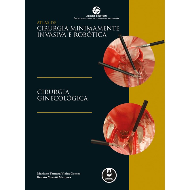 Livro Atlas de Cirurgia Minimamente Invasiva e Robótica - Cirurgia Ginecológica - Gomes