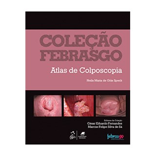 Livro Atlas de Colposcopia - Speck - Gen Guanabara