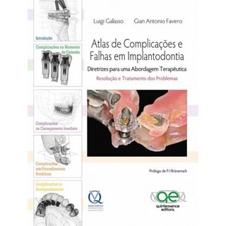 Livro - Atlas de Complicacoes e Falhas em Implantodontia - Diretrizes para Uma Abor - Galasso/favero