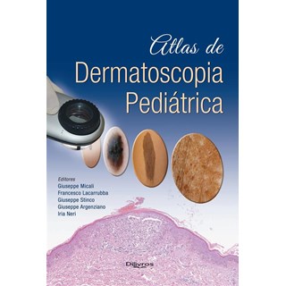 Livro - Atlas de Dermatoscopia Pediatrica - Micali/lacarrubba/st