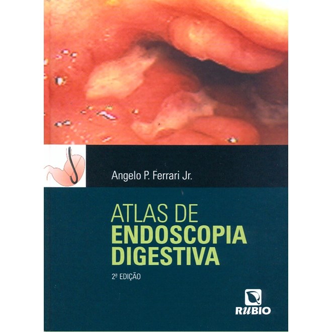 Livro Atlas de Endoscopia Digestiva - Ferrari - Rúbio