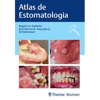 Livro Atlas de Estomatologia - Dedivitis - Revinter