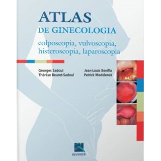 Livro - Atlas de Ginecologia - Colposcopia, Vulvoscopia, Histeroscopia, Laparoscopi - Sadoul/beuret-sadoul
