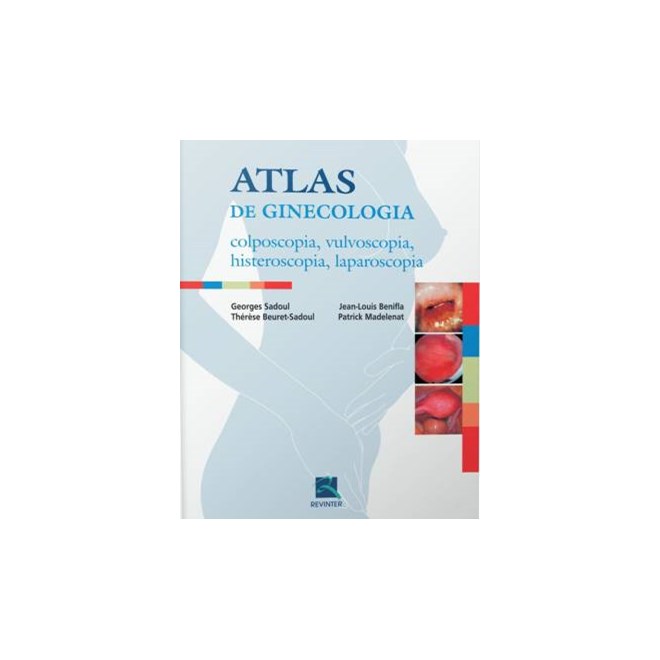 Livro - Atlas de Ginecologia - Colposcopia, Vulvoscopia, Histeroscopia, Laparoscopi - Sadoul/beuret-sadoul