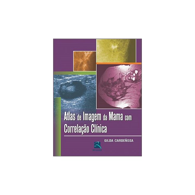 Livro - Atlas de Imagem da Mama com Correlacao Clinica - Cardenosa