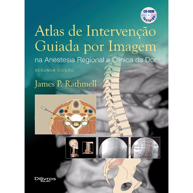 Livro - Atlas de Intervencao Guiada por Imagem Na Anestesia Regional e Clinica da D - Rathmell