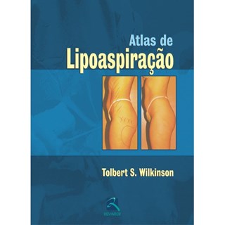 Livro - Atlas de Lipoaspiracao - Wilkinson