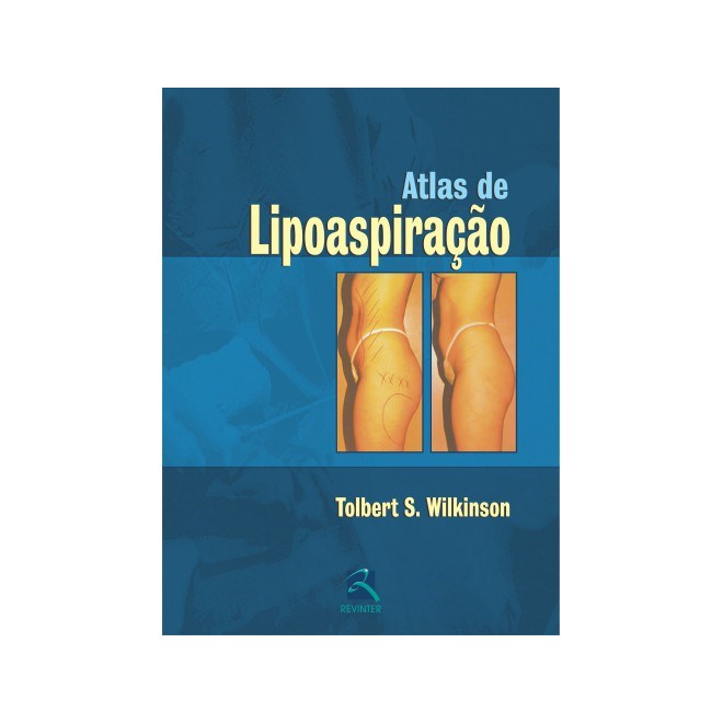 Livro Atlas de Lipoaspiração - Wilkinson - Revinter