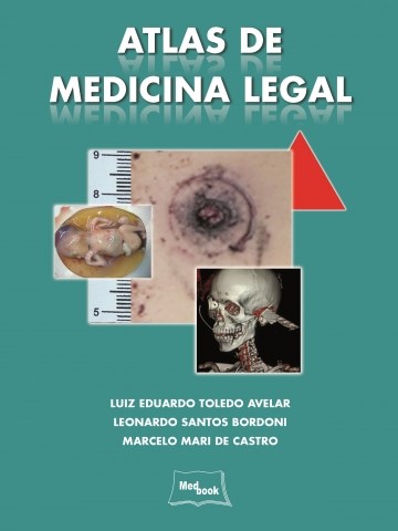 Atlas De Medicina Legal Online