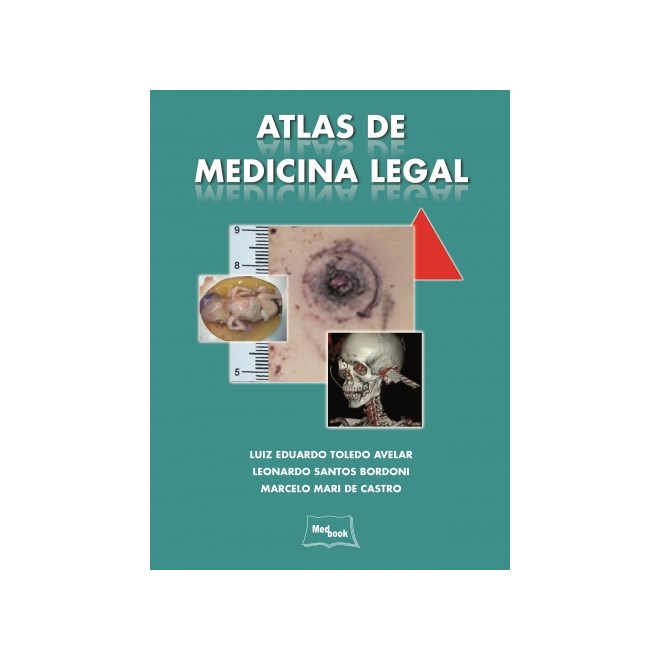 Livro Atlas de Medicina Legal - Avelar - Medbook