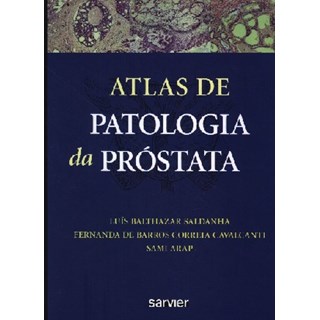 Livro - Atlas de Patologia da Prostata - Saldanha