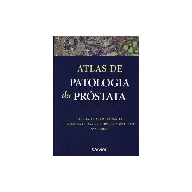 Livro - Atlas de Patologia da Prostata - Saldanha