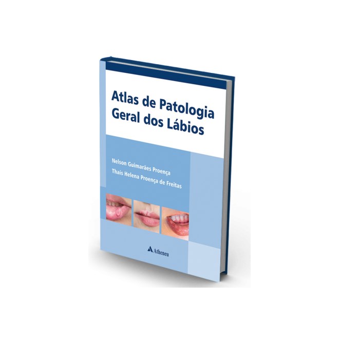 Livro - Atlas de Patologia Geral dos Labios - Proenca/freitas