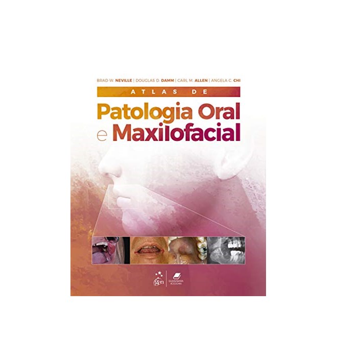 Livro Atlas de Patologia Oral e Maxilofacial - Neville - Guanabara