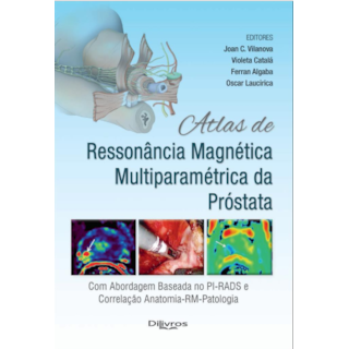 Livro - Atlas de Ressonancia Magnetica Multiparametrica da Prostata - Vilanova/catala/alga