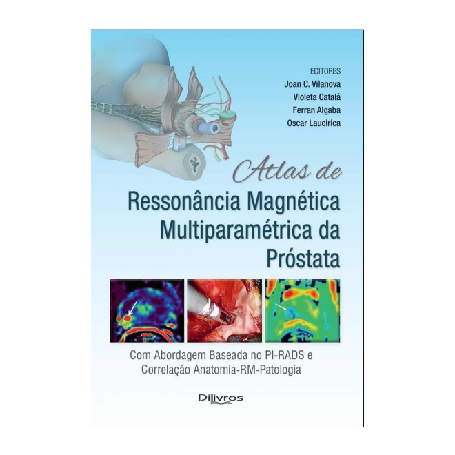 Livro - Atlas de Ressonancia Magnetica Multiparametrica da Prostata - Vilanova/catala/alga