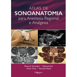 Livro - Atlas de Sonoanatomia para Anestesia Regional e Analgesia- Karmakar