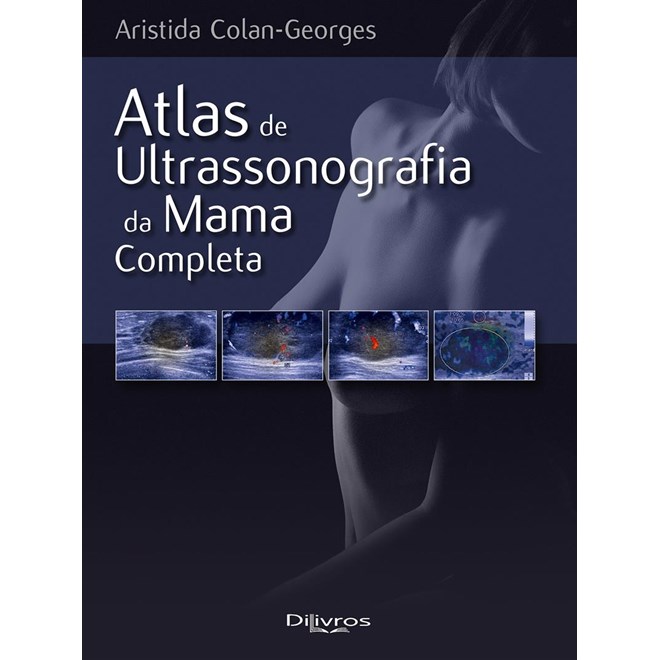 Livro - Atlas de Ultrassonografia da Mama Completa - Colan-Georges - DiLivros