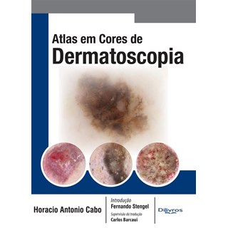 Livro - Atlas em Cores de Dermatoscopia - Cabo