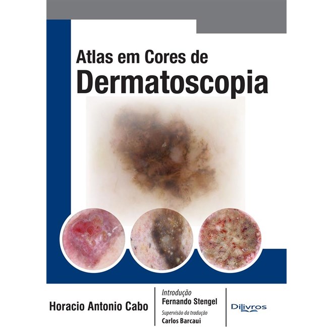 Livro - Atlas em Cores de Dermatoscopia - Cabo