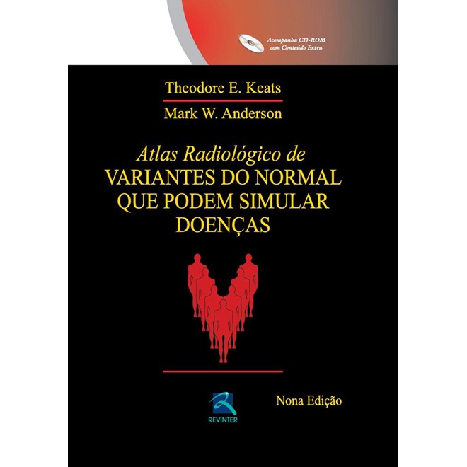Livro - Atlas Radiologico de Variantes do Normal Que Podem Simular Doencas - Keats/anderson