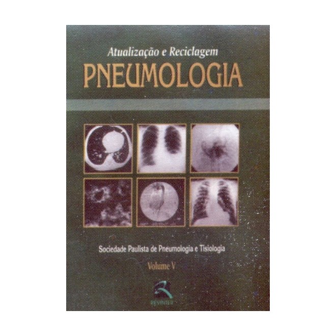 Livro - Atualizacao e Reciclagem Pneumologia Vol 5 - Sppt