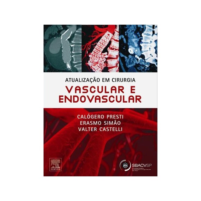 Livro - Atualização em Cirurgia Vascular e Endovascular - Presti #
